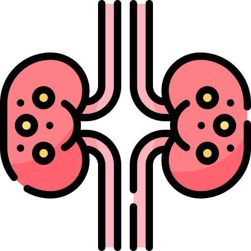 kidney-stone_14777312